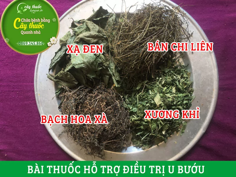 Bài thuốc hỗ trợ điều trị u bướu, u hạch (ung thư) được sử dụng nhiều nhất hiện nay