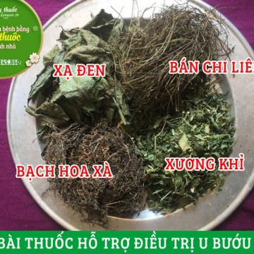 Bài thuốc hỗ trợ điều trị u bướu, u hạch (ung thư) được sử dụng nhiều nhất hiện nay